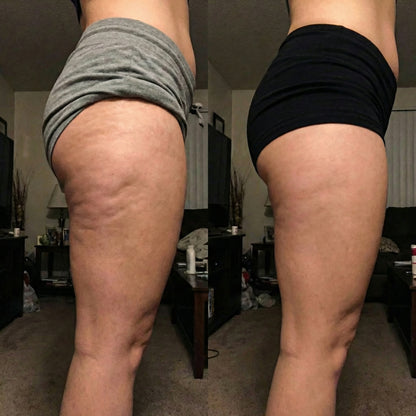 LIPO-SCULPT™ | 3D Metabolic Booster Leggings