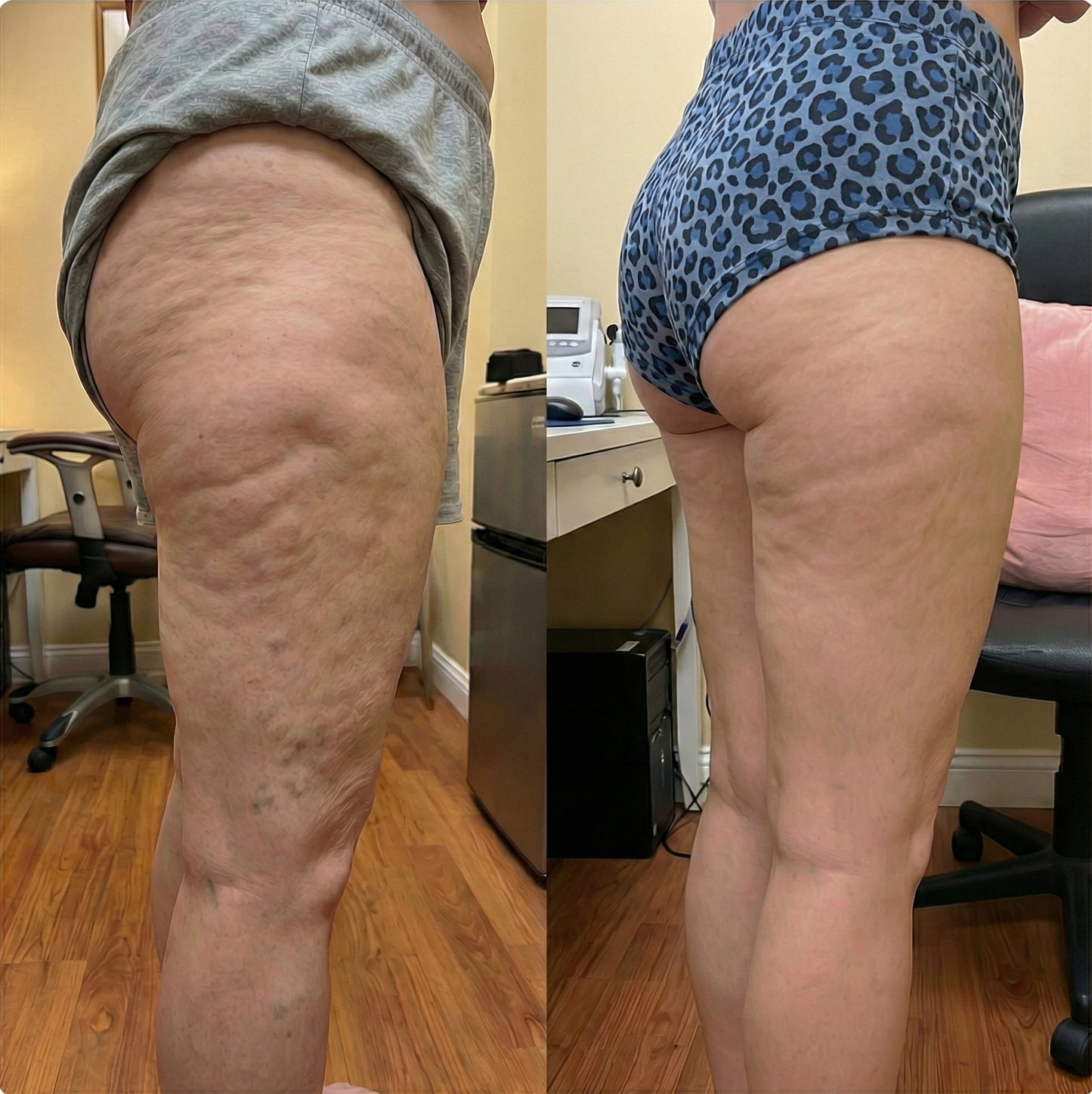 LIPO-SCULPT™ | 3D Metabolic Booster Leggings