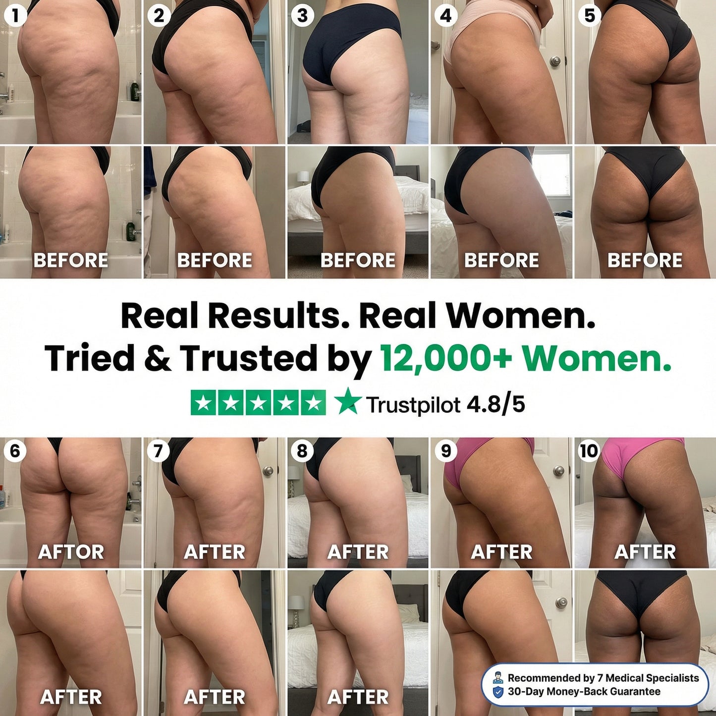 LIPO-SCULPT™ | 3D Metabolic Booster Shorts