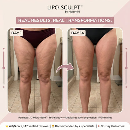 LIPO-SCULPT™ | 3D Metabolic Booster Shorts